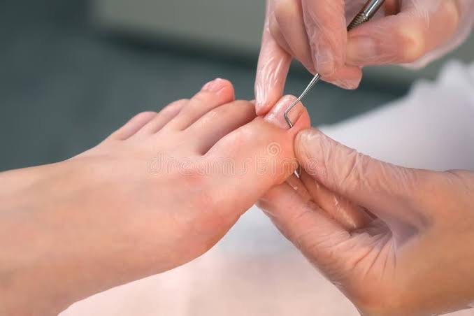 Pedicure